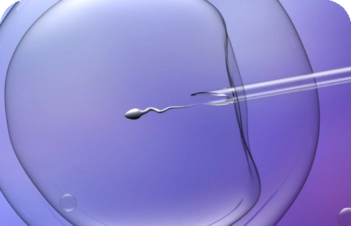 Intracytoplasmic Sperm Injection (ICSI)