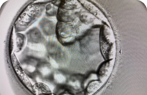 In Vitro Fertilisation (IVF)