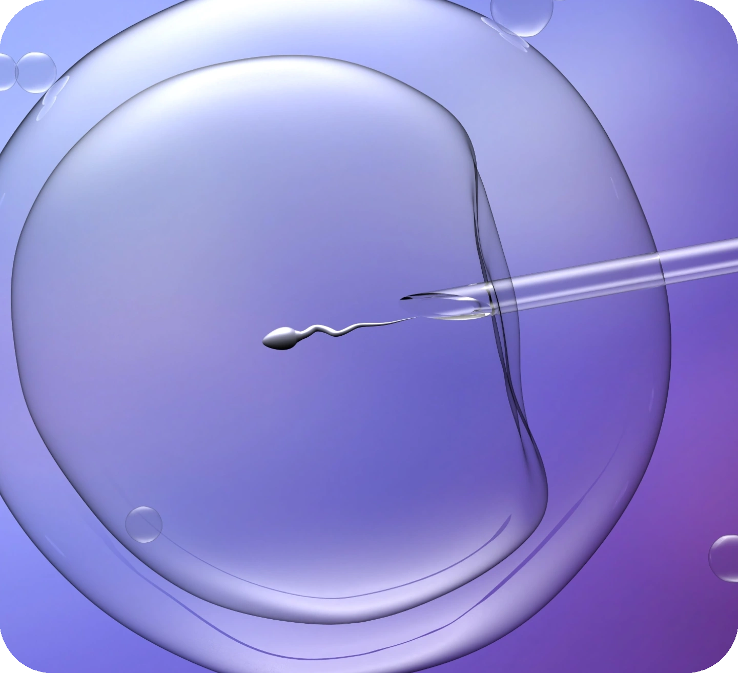 Intracytoplasmic Sperm Injection Fertility Specialist Mackay